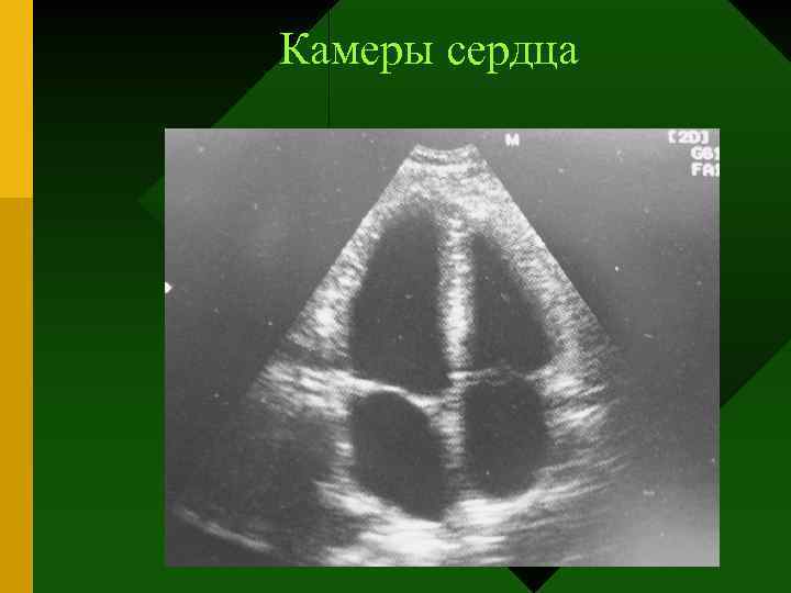 Камеры сердца 