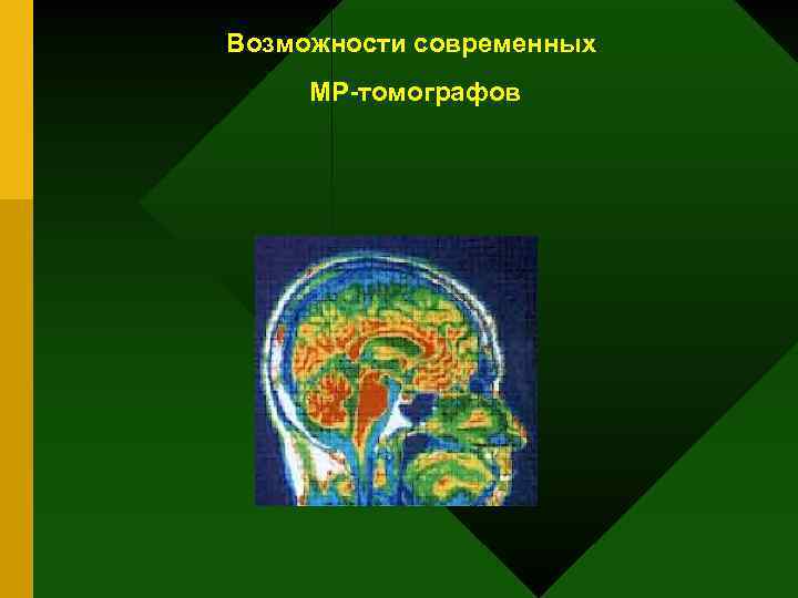 Возможности современных МР томографов 