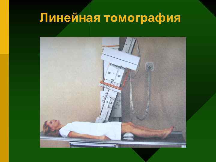 Линейная томография 