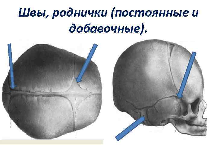 Узи швов черепа