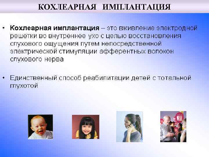 КОХЛЕАРНАЯ ИМПЛАНТАЦИЯ 