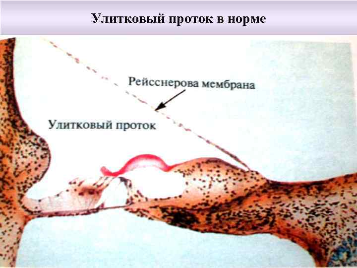 Стенки улиткового протока