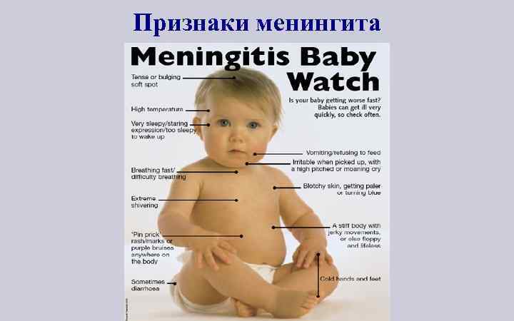 Признаки менингита 