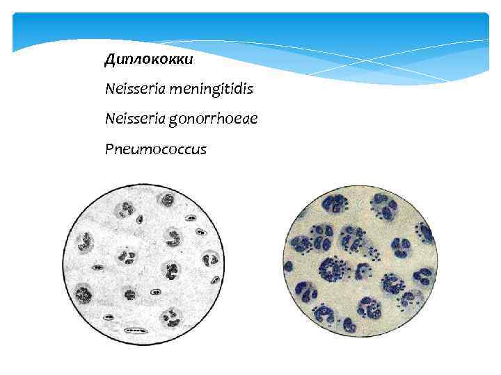Диплококки Neisseria meningitidis Neisseria gonorrhoeae Pneumococcus 