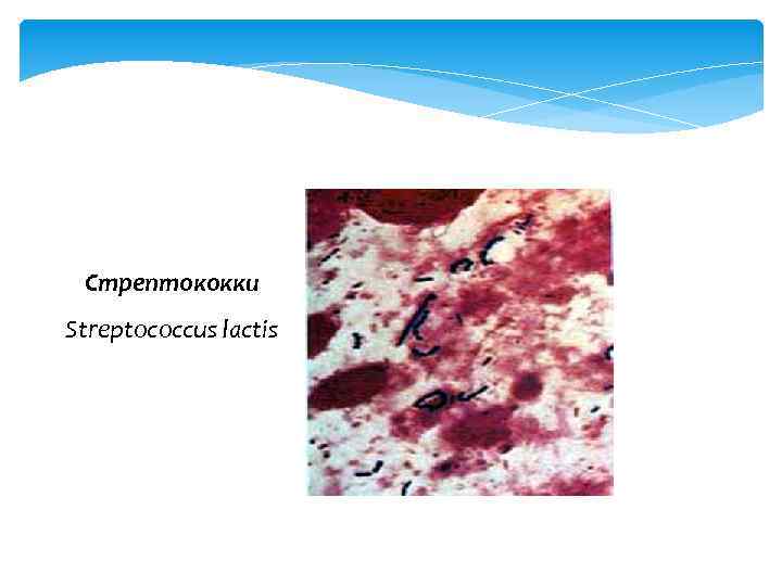 Стрептококки Streptococcus lactis 