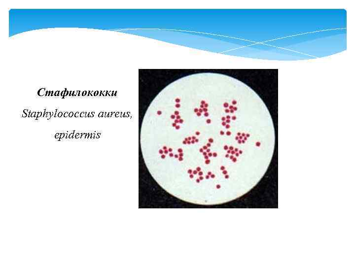 Стафилококки Staphylococcus aureus, epidermis 