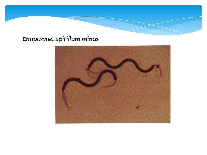 Спириллы. Spirillum minus 