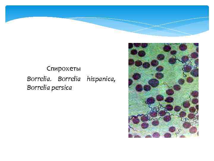 Спирохеты Borrelia hispanica, Borrelia persica 