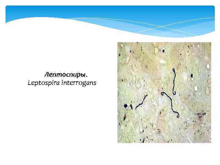 Лептоспиры. Leptospira interrogans 