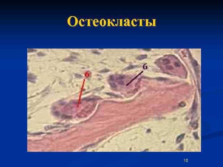 Остеокласты 10 