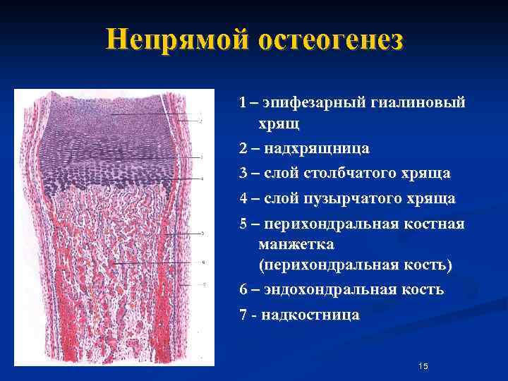 Непрямой остеогенез схема