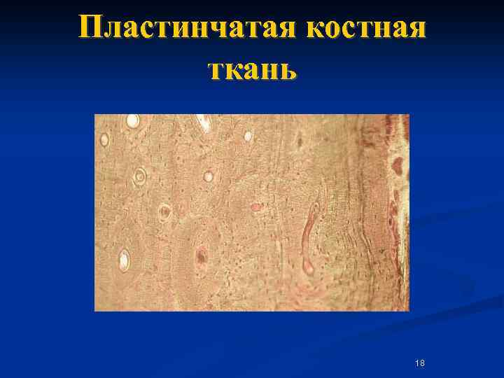Пластинчатая костная ткань 18 