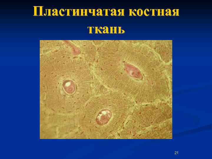 Пластинчатая костная ткань 21 