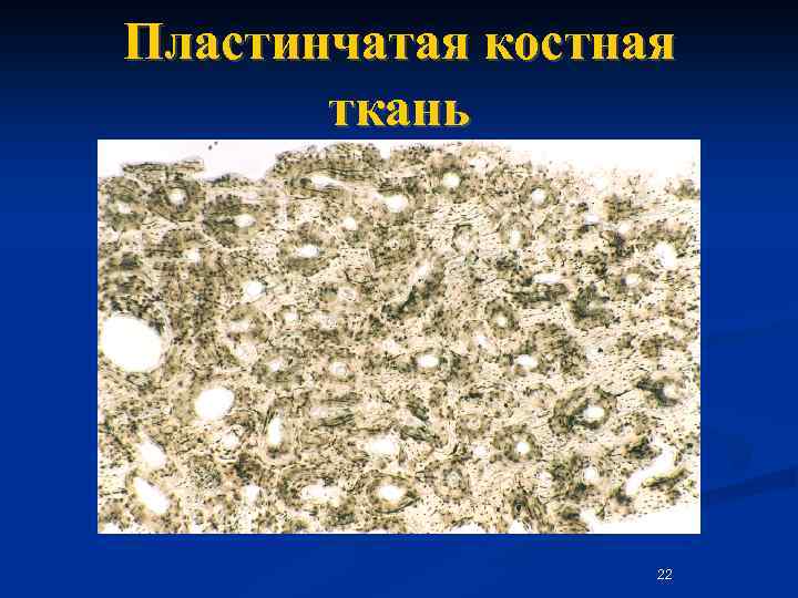 Пластинчатая костная ткань 22 