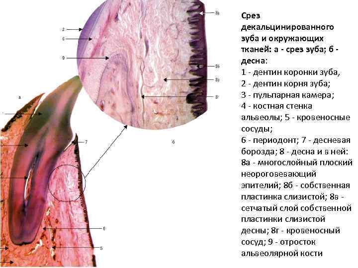 Срез декальцинированного зуба и окружающих тканей: а - срез зуба; б - десна: 1