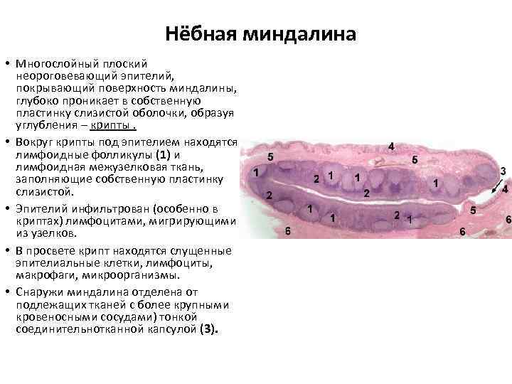Нёбная миндалина • Многослойный плоский неороговевающий эпителий, покрывающий поверхность миндалины, глубоко проникает в собственную