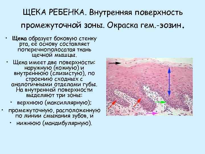 ЩЕКА РЕБЕНКА. Внутренняя поверхность промежуточной зоны. Окраска гем. -эозин. • Щека образует боковую стенку