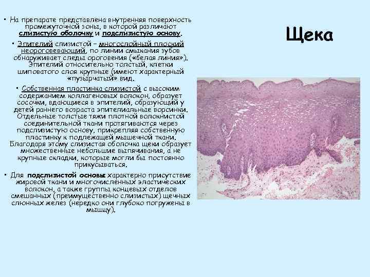  • На препарате представлена внутренняя поверхность промежуточной зоны, в которой различают слизистую оболочку