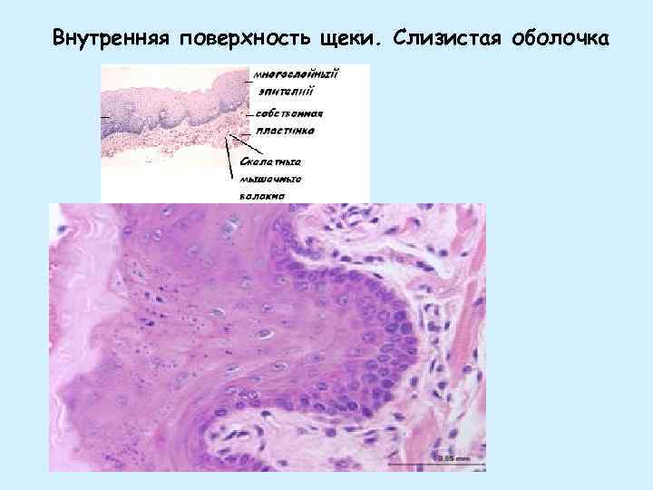 Слизистая гортани фото