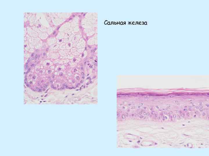 Как выглядит сальная железа на рисунке