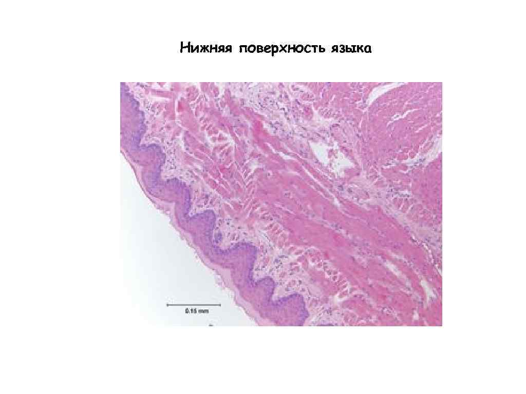 Язык гистология. Нижняя поверхность языка гистология. Нижняя поверхность языка гистология препарат. Вентральная поверхность языка гистология. Вентральная поверхнорстьязыка.