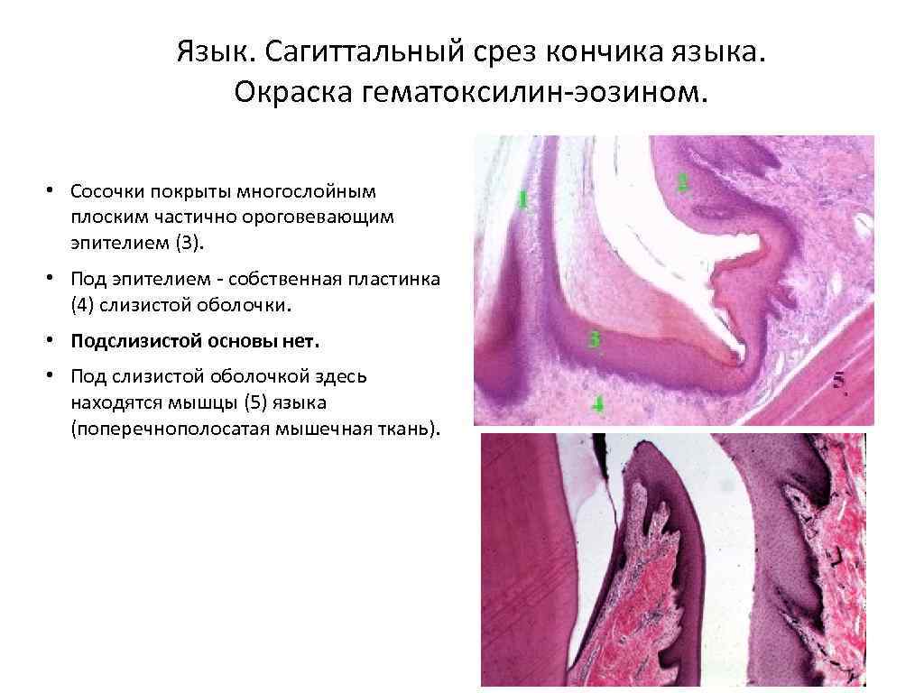 Гистология нитевидные сосочки языка рисунок