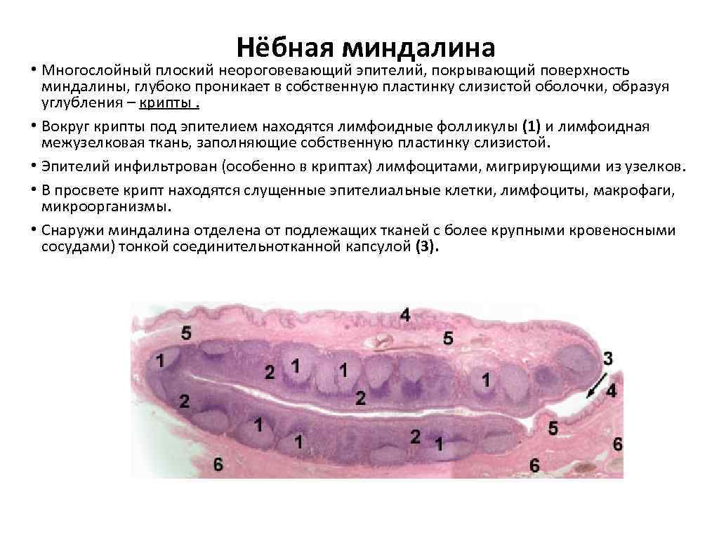 Небная миндалина гистология рисунок