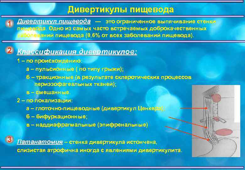 Заболевания пищевода хирургия презентация