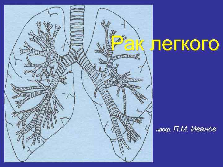 Рак легкого проф. П. М. Иванов 