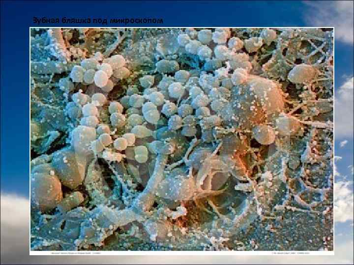 Зубная бляшка под микроскопом 