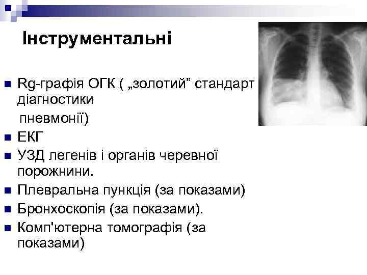 Інструментальні n n n Rg-графія ОГК ( „золотий” стандарт діагностики пневмонії) ЕКГ УЗД легенів