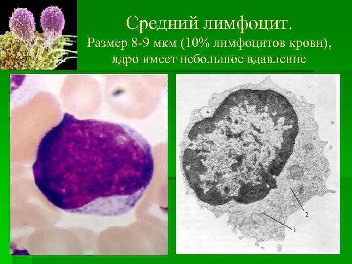 Средний лимфоцит. Размер 8 -9 мкм (10% лимфоцитов крови), ядро имеет небольшое вдавление 