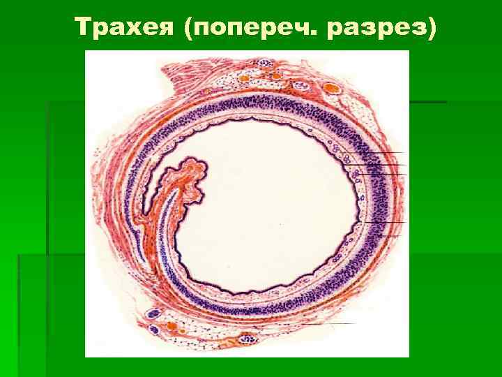 Трахея (попереч. разрез) 