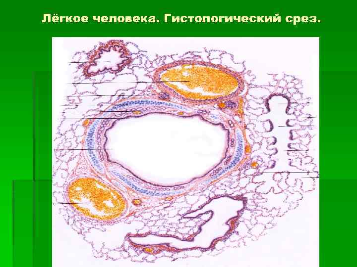Лёгкое человека. Гистологический срез. 