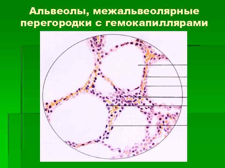 Альвеолы, межальвеолярные перегородки с гемокапиллярами 