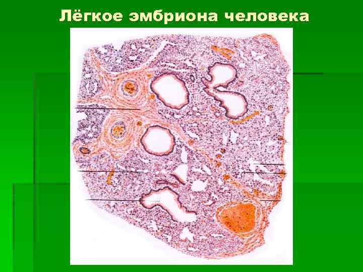 Лёгкое эмбриона человека 
