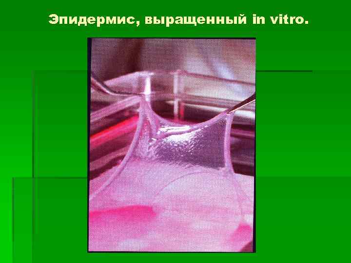 Эпидермис, выращенный in vitro. 