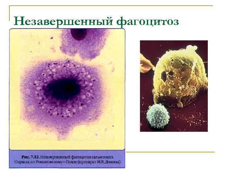 Незавершенный фагоцитоз 
