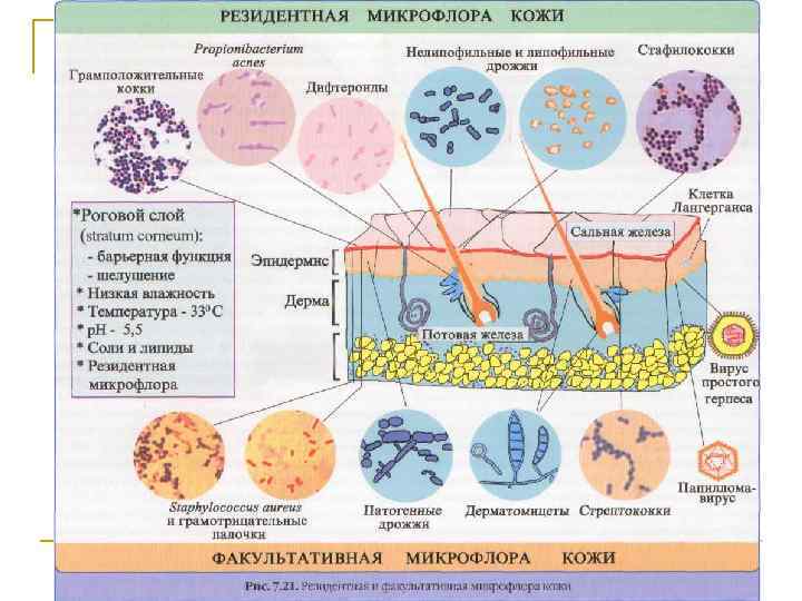 Разновидности иммунитета схема