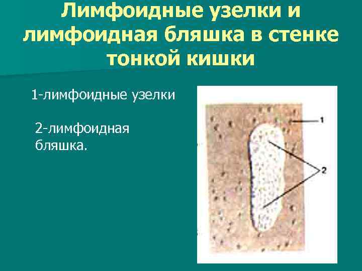 Лимфоидные узелки и лимфоидная бляшка в стенке тонкой кишки 1 -лимфоидные узелки 2 -лимфоидная