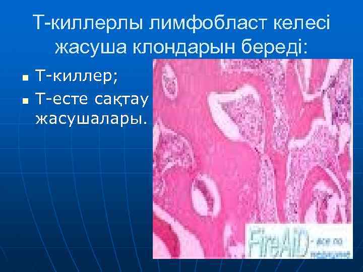 Т-киллерлы лимфобласт келесі жасуша клондарын береді: n n Т-киллер; Т-есте сақтау жасушалары. 