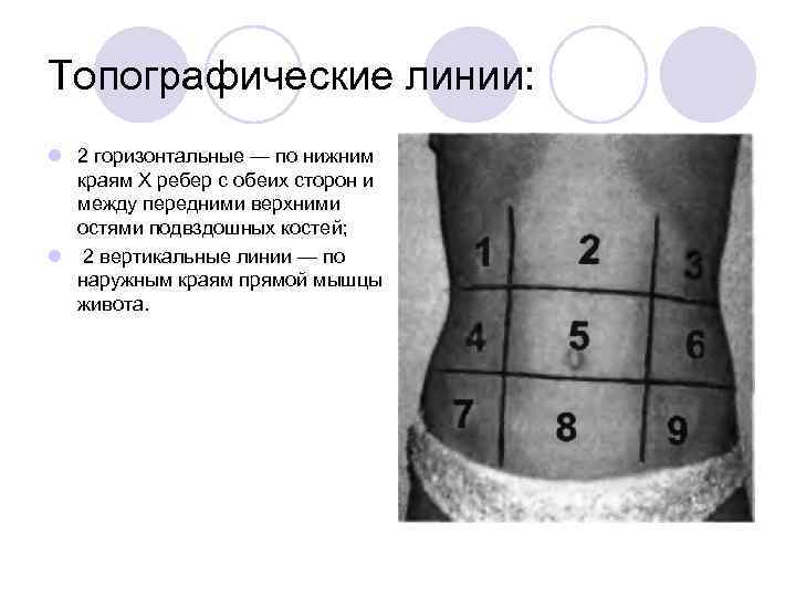 Топографические линии: l 2 горизонтальные — по нижним краям X ребер с обеих сторон