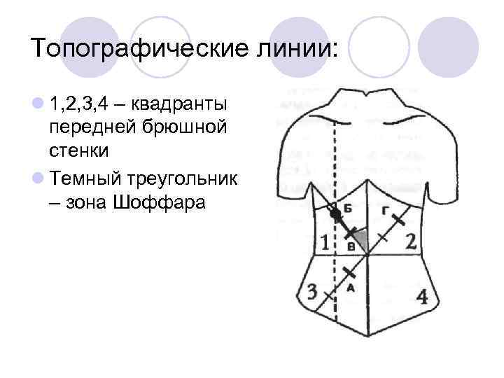 Топографические линии: l 1, 2, 3, 4 – квадранты передней брюшной стенки l Темный