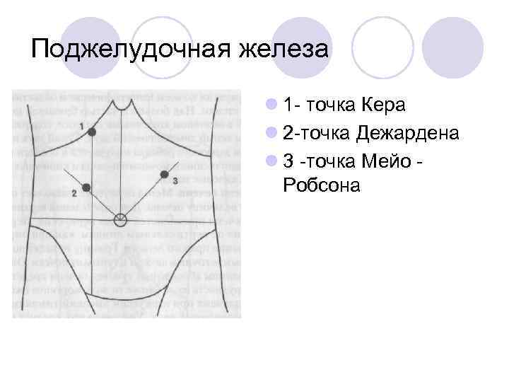 Поджелудочная железа l 1 - точка Кера l 2 -точка Дежардена l 3 -точка