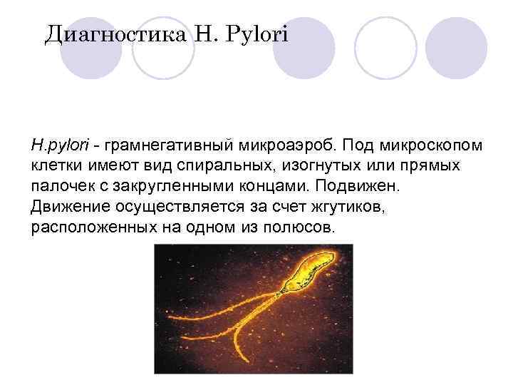 Диагностика H. Pylori H. pylori - грамнегативный микроаэроб. Под микроскопом клетки имеют вид спиральных,