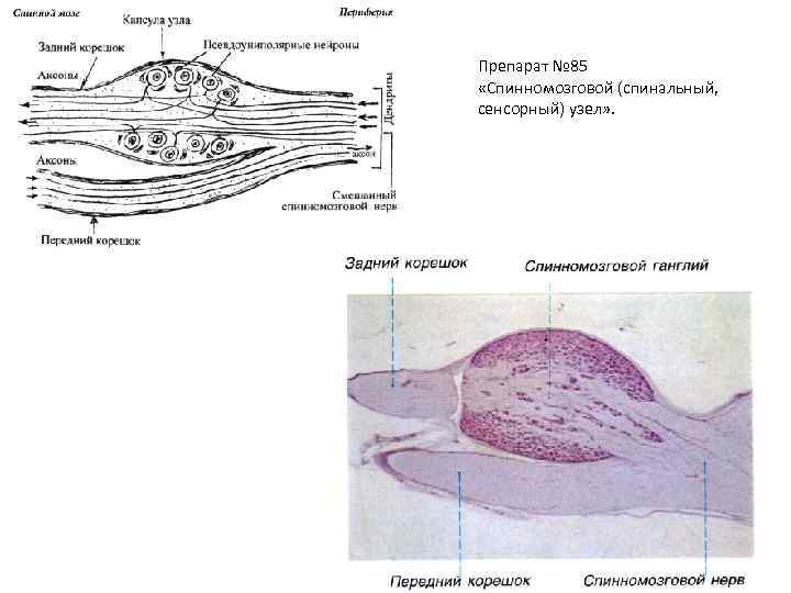 Препарат № 85 «Спинномозговой (спинальный, сенсорный) узел» . 