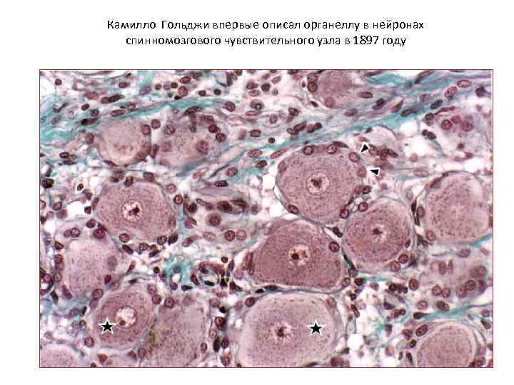 Камилло Гольджи впервые описал органеллу в нейронах спинномозгового чувствительного узла в 1897 году 