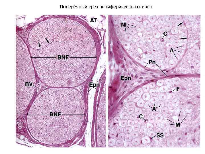 Поперечный срез периферического нерва 