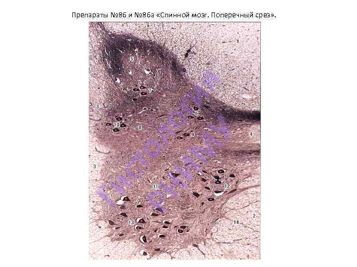 Ги ст ол РН о И М ги я У Препараты № 86 и