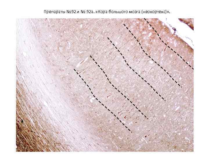 Препараты № 92 и № 92 а. «Кора большого мозга (неокортекс)» . 